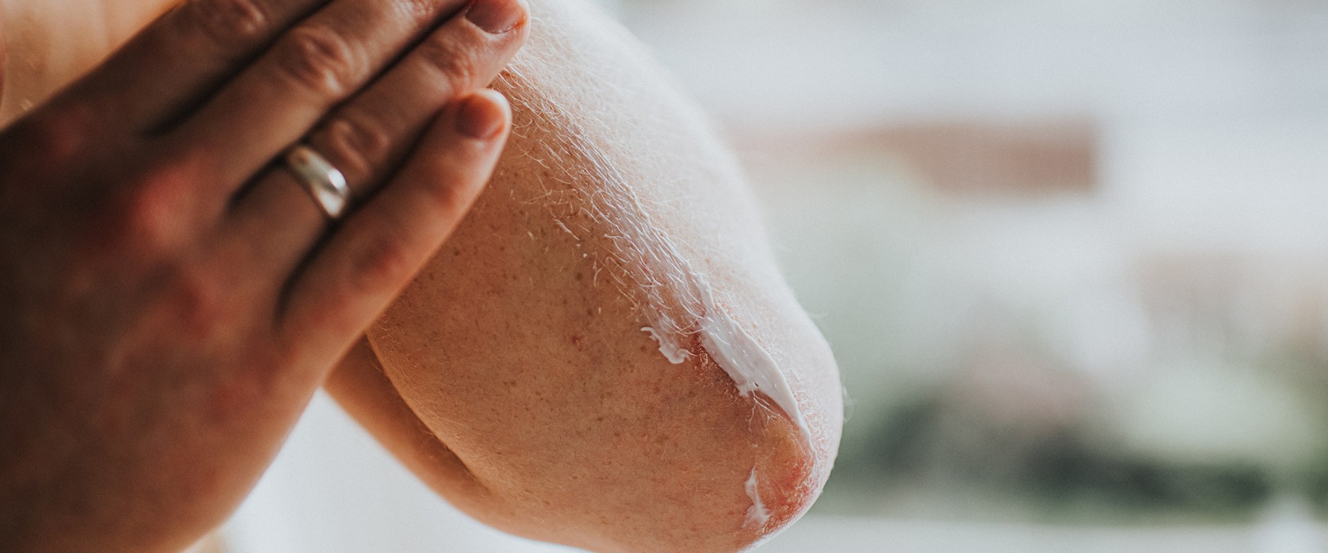 Understanding the Causes of Dry Skin